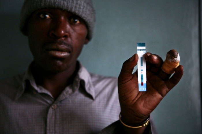 Смертность от СПИДа в Кении пугающе высока.
