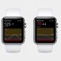 Новые смарт-часы Apple и Samsung могут получить функцию измерения уровня сахара в крови